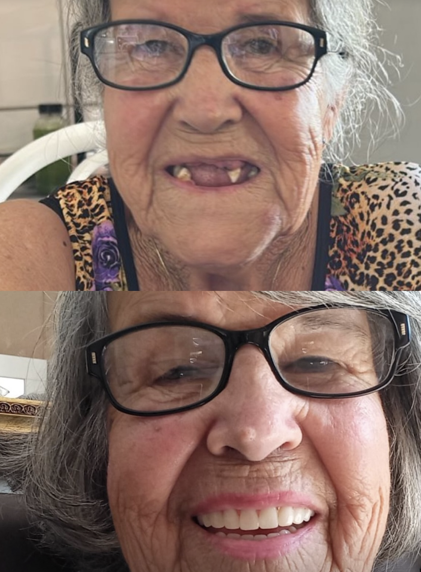 Antes e depois de reabilitação oral