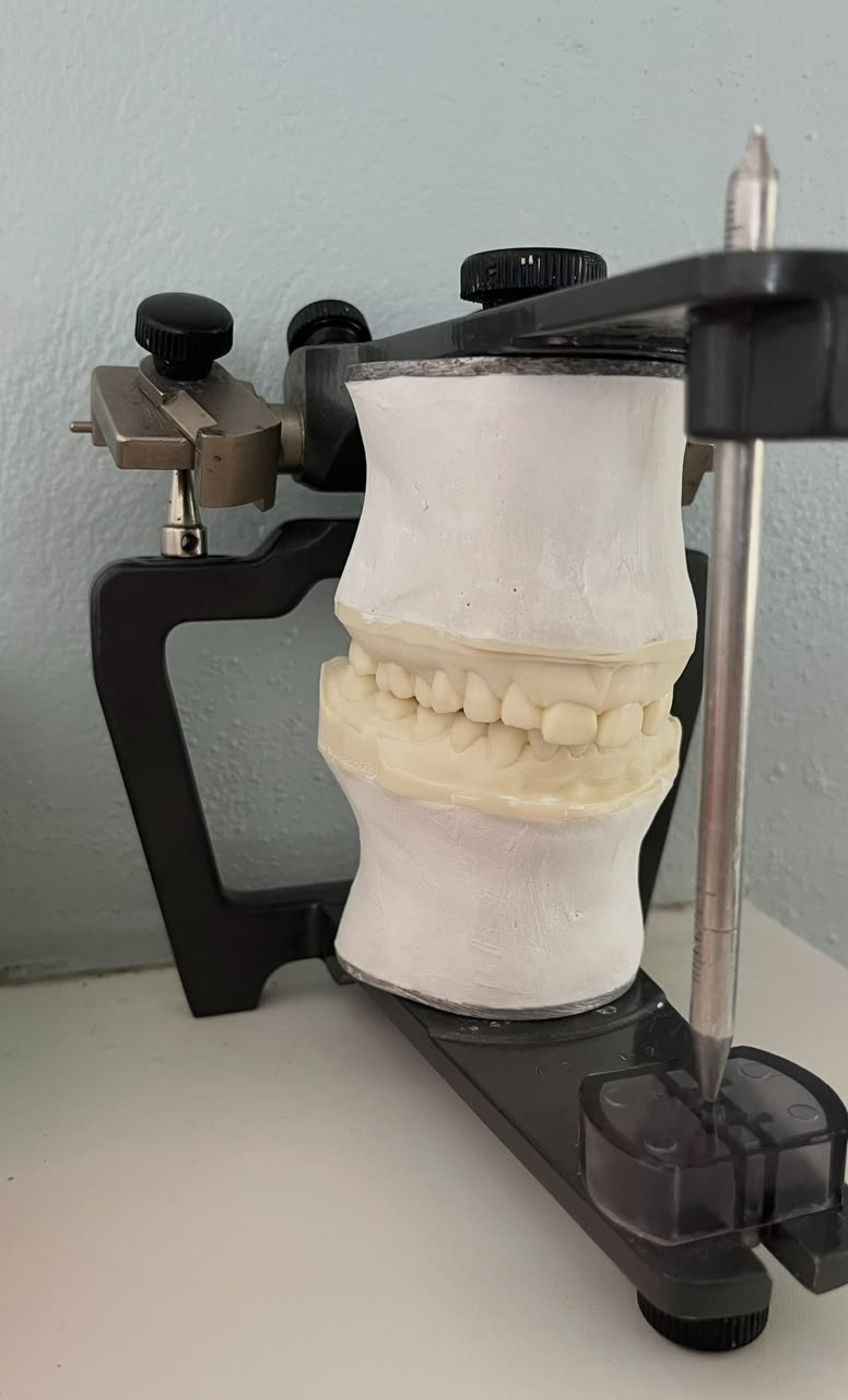 Articulador