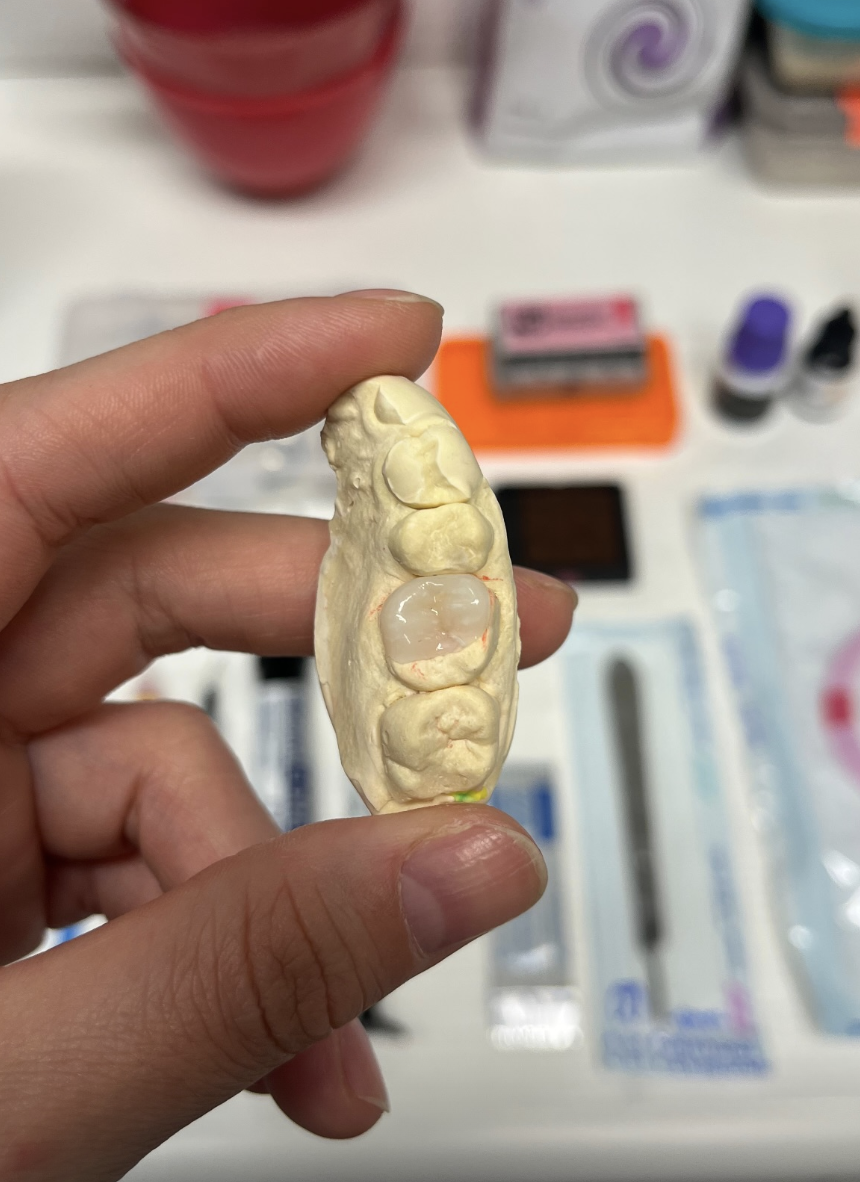 Modelo com coroa provisória